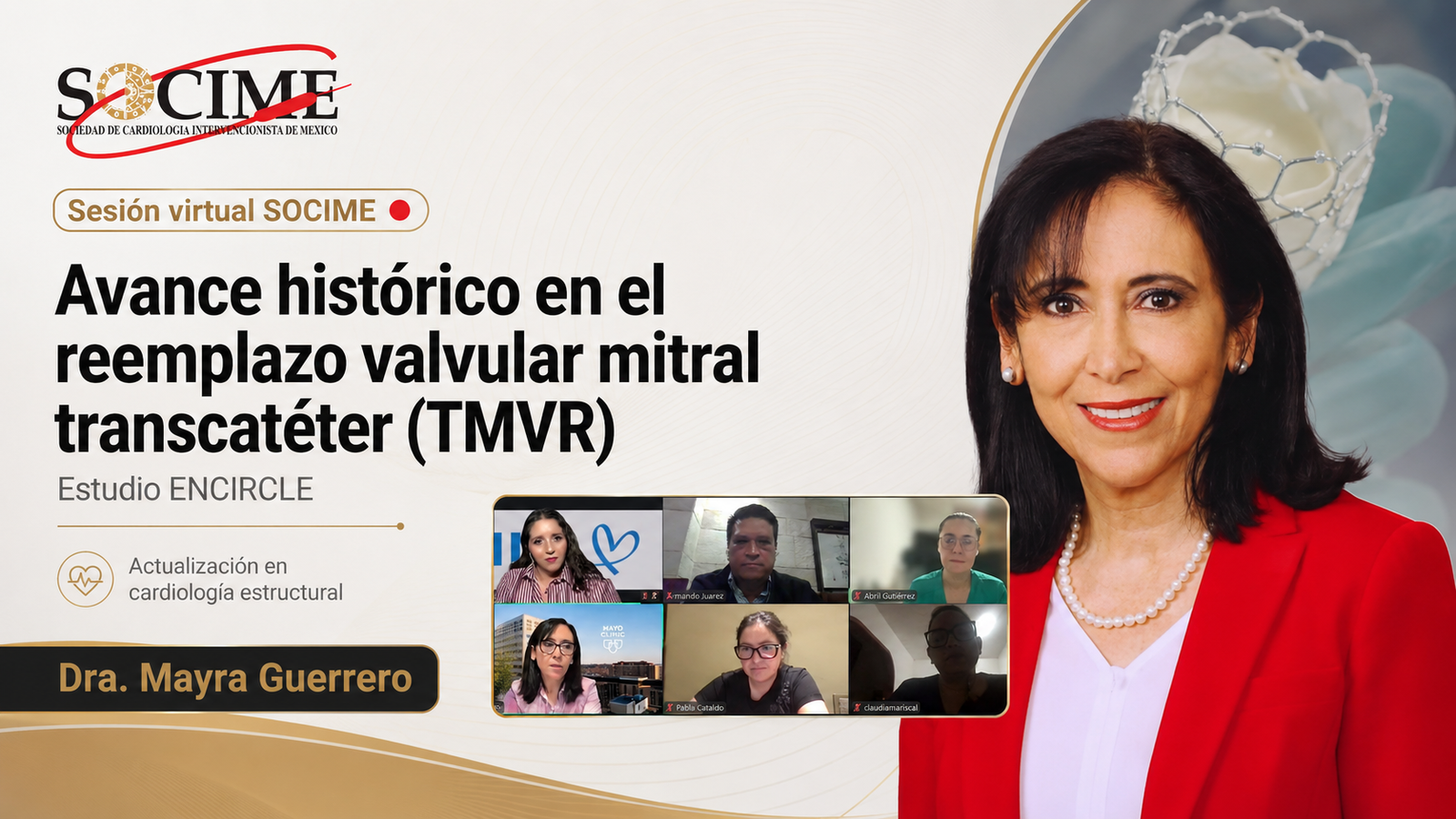 SOCIME realizó sesión virtual sobre avances en reemplazo valvular mitral transcatéter