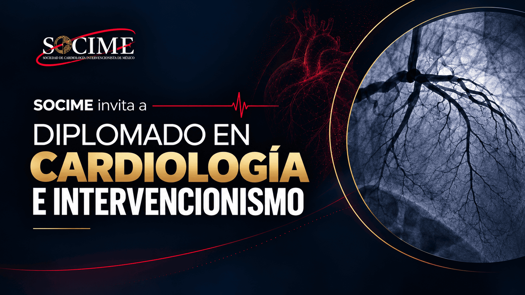 Diplomado en Cardiología e Intervencionismo 2026-2027: una oportunidad de formación especializada en enfermería